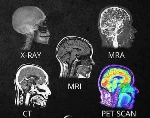 مختلف جسمانی Scans